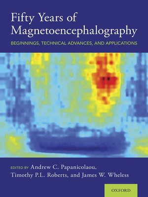 cover image of Fifty Years of Magnetoencephalography